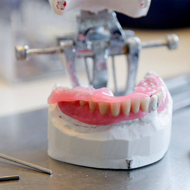 Tandprotese aftryk, mål til protese